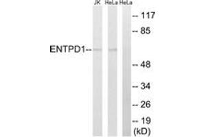 Western blot analysis of extracts from HeLa/Jurkat cells, using ENTPD1 Antibody. (CD39 antibody  (AA 351-400))