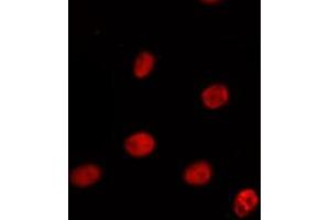 ABIN6275394 staining Hela by IF/ICC. (PRPF38A antibody  (Internal Region))