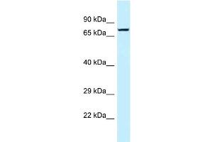 WB Suggested Anti-TNS4 Antibody Titration: 1.