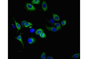 Immunofluorescence (IF) image for anti-Tumor Necrosis Factor Receptor Superfamily, Member 1A (TNFRSF1A) (AA 263-468) antibody (ABIN7173825)