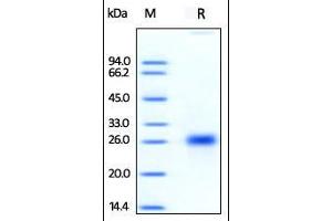 Human OX40 Ligand, His Tag (HPLC-verified) on SDS-PAGE under reducing (R) condition.