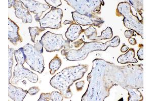 Immunohistochemistry (IHC) image for anti-Mucin 1 (MUC1) (AA 1062-1139) antibody (ABIN5693192)