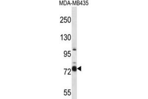 Western Blotting (WB) image for anti-Cas Scaffolding Protein Family Member 4 (CASS4) antibody (ABIN2997369) (CASS4 antibody)
