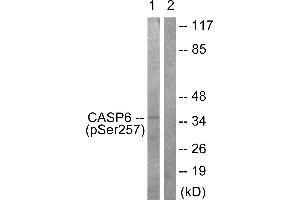 Immunohistochemistry analysis of paraffin-embedded human colon carcinoma tissue using Caspase 6 (Phospho-Ser257) antibody. (Caspase 6 antibody  (pSer257))