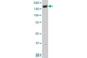 CADPS polyclonal antibody (A01), Lot # 060608JCS1 Western Blot analysis of CADPS expression in Y-79 . (CADPS antibody  (AA 1256-1353))