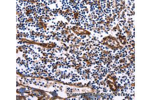 Immunohistochemistry of Human tonsil using DUSP6 Polyclonal Antibody at dilution of 1:25