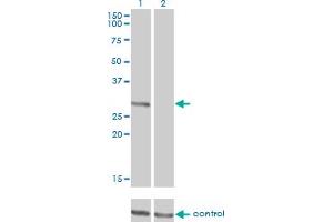 Western blot analysis of FCER1A over-expressed 293 cell line, cotransfected with FCER1A Validated Chimera RNAi (Lane 2) or non-transfected control (Lane 1). (Fc epsilon RI/FCER1A antibody  (AA 1-257))