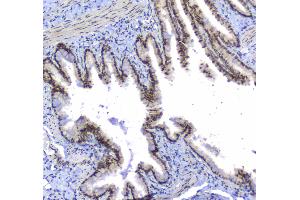 IHC analysis of splicing factor 1 using anti-splicing factor 1 antibody . (Splicing Factor 1 antibody  (AA 160-266))