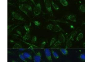 Immunofluorescence analysis of U-2 OS cells using GLUD1 Polyclonal Antibody at dilution of 1:100. (GLUD1 antibody)