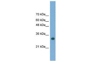 WB Suggested Anti-FAM78A Antibody Titration: 0. (FAM78A antibody  (C-Term))