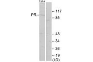 Western blot analysis of extracts from HeLa cells, using Progesterone Receptor (Ab-400) Antibody. (Progesterone Receptor antibody  (AA 371-420))