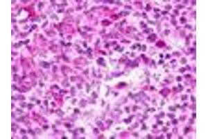 Anti-GPR183 / EBI2 antibody IHC of human lymph node. (GPR183 antibody  (Cytoplasmic Domain))