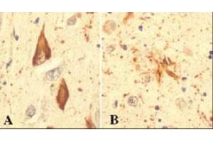 Immunohistochemical staining of RPS27A in hippocampal tissue from an Alzheimer patient, using RPS27A monoclonal antibody, clone Ubi-1 . (RPS27A antibody)