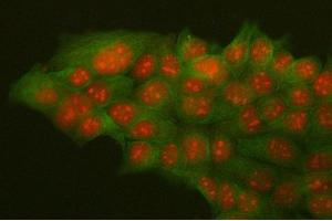 IF analysis of HMGB2 and Tubulin alpha using anti-HMGB2 antibody (ABIN4886620) and anti-Tubulin alpha antibody (ABIN7600339). (HMGB2 antibody  (N-Term))