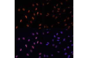 Immunofluorescence analysis of NIH/3T3 cells using Acetyl-Histone H2B-K12 antibody (ABIN7267731) at dilution of 1:100. (Histone H2B antibody  (acLys12))