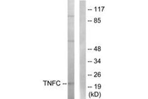Western blot analysis of extracts from HepG2 cells, using TNFC Antibody. (LTB antibody  (AA 181-230))