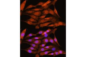 Immunofluorescence analysis of NIH/3T3 cells using BCL3 Rabbit pAb (ABIN6134239, ABIN6137509, ABIN6137510 and ABIN7101379) at dilution of 1:100. (BCL3 antibody  (AA 300-400))