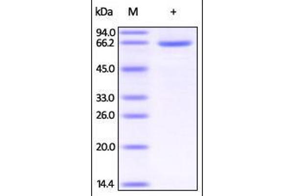 HSA Protein (AA 25-609) (His tag)