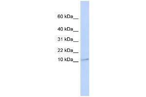 WB Suggested Anti-TMEM93 Antibody Titration:  0. (TMEM93 antibody  (N-Term))