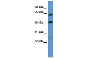 WB Suggested Anti-GPRC5B Antibody Titration: 0. (GPRC5B antibody  (N-Term))