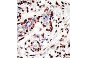 Image no. 1 for anti-Myeloid/lymphoid Or Mixed-Lineage Leukemia (MLL) (C-Term) antibody (ABIN356674) (MLL/KMT2A antibody  (C-Term))