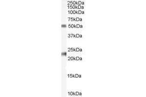 Western Blotting (WB) image for anti-Fibulin 5 (FBLN5) antibody (ABIN5866195) (Fibulin 5 antibody)