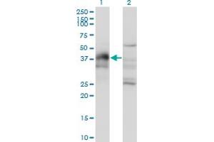 Western Blot analysis of DLX3 expression in transfected 293T cell line by DLX3 monoclonal antibody (M03), clone 3C3. (DLX3 antibody  (AA 1-287))