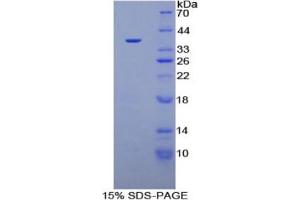 SDS-PAGE of Protein Standard from the Kit (Highly purified E. (PLG CLIA Kit)