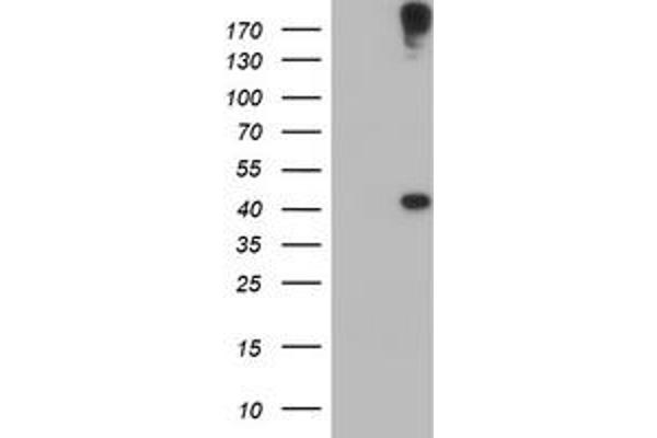 AGPAT5 antibody