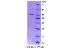 SDS-PAGE (SDS) image for Actinin, alpha 3 (ACTN3) (AA 162-416) protein (His tag) (ABIN2123890) (ACTN3 Protein (AA 162-416) (His tag))