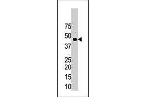 The STRADA polyclonal antibody  is used in Western blot to detect STRADA in mouse brain tissue lysate. (STRADA antibody  (N-Term))
