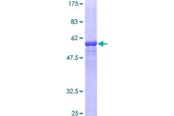 F12 Protein (AA 1-300) (GST tag)