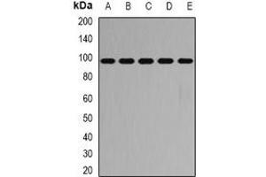 Western blot analysis of PYGB expression in SW620 (A), HT29 (B), mouse heart (C), mouse lung (D), rat brain (E) whole cell lysates. (PYGB antibody)