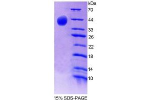 SDS-PAGE analysis of Mouse SYN2 Protein. (SYN2 Protein)