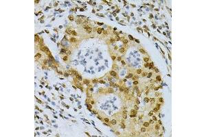 Immunohistochemistry (Paraffin-embedded Sections) (IHC (p)) image for anti-ELAV (Embryonic Lethal, Abnormal Vision, Drosophila)-Like 1 (Hu Antigen R) (ELAVL1) (AA 1-326) antibody (ABIN3022231)