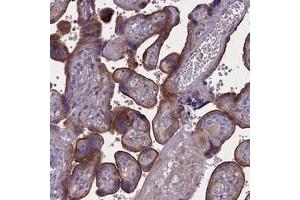 Immunohistochemical staining of human placenta with PLEKHG6 polyclonal antibody  shows strong membranous staining positivity in trophoblastic cells. (PLEKHG6 antibody)
