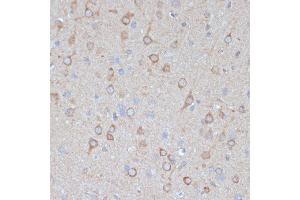 Immunohistochemistry of paraffin-embedded rat brain using COPG2 antibody (ABIN7266425) at dilution of 1:100 (40x lens). (COPG2 antibody  (AA 542-871))
