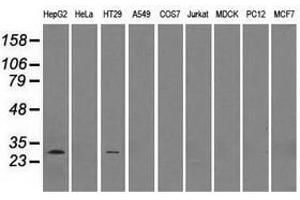 Image no. 2 for anti-Replication Protein A2, 32kDa (RPA2) antibody (ABIN1500734) (RPA2 antibody)