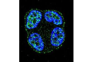 Confocal immunofluorescent analysis of SCUBE2 Antibody (Center ) (ABIN655409 and ABIN2844955) with ZR-75-1 cell followed by Alexa Fluor 488-conjugated goat anti-rabbit lgG (green). (SCUBE2 antibody  (AA 251-280))