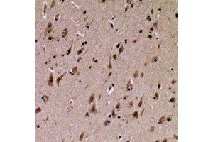 Immunohistochemical analysis of SFT2D3 staining in human brain formalin fixed paraffin embedded tissue section. (SFT2D3 antibody)