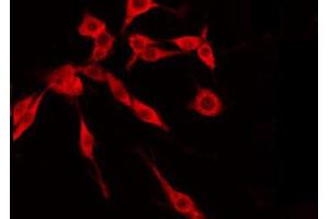 ABIN6274845 staining Hela by IF/ICC. (TMEM237 antibody  (Internal Region))