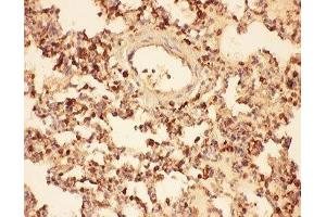 IHC-P testing of rat lung tissue (Cofilin antibody  (AA 2-166))