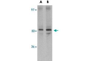 Western blot analysis of JMJD6 in human brain tissue lysate with JMJD6 polyclonal antibody  at (A) 1 and (B) 2 ug/mL . (JMJD6 antibody  (N-Term))