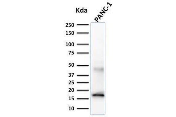 Elastase 3B 抗体  (AA 82-238)