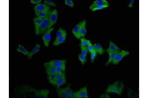 Immunofluorescence staining of HepG2 cells with ABIN7169835 at 1:66, counter-stained with DAPI. (KCNN3 antibody  (AA 240-426))
