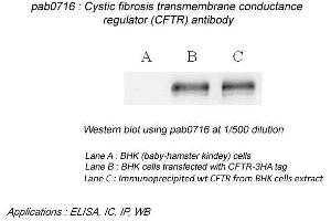 Image no. 2 for anti-Cystic Fibrosis Transmembrane Conductance Regulator (ATP-Binding Cassette Sub-Family C, Member 7) (CFTR) (N-Term) antibody (ABIN559719) (CFTR antibody  (N-Term))