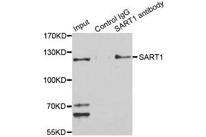 Immunoprecipitation analysis of 150ug extracts of Jurkat cells using 3ug SART1 antibody. (SART1 antibody  (AA 1-255))