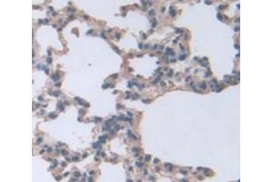 IHC-P analysis of Rat Tissue, with DAB staining. (Sonic Hedgehog antibody  (AA 28-192))