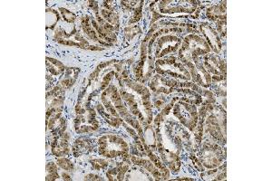 IHC analysis of Transketolase/TKT using anti-Transketolase/TKT antibody (ABIN7598957). (TKT antibody  (AA 1-116))