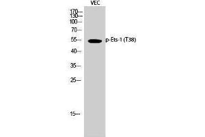 Western Blotting (WB) image for anti-V-Ets erythroblastosis Virus E26 Oncogene Homolog 1 (Avian) (ETS1) (pThr38) antibody (ABIN3182755) (ETS1 antibody  (pThr38))